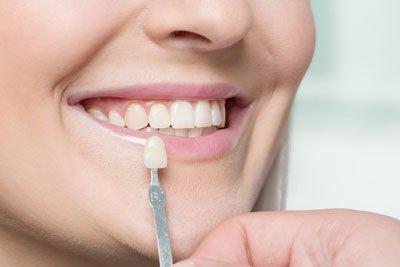 Cosmetic Dentistry | Dental Care in Icon Clinic - Abu Dhabi