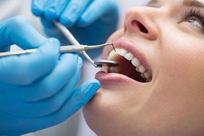 General Dentistry | Dental Care in Icon Clinic - Abu Dhabi